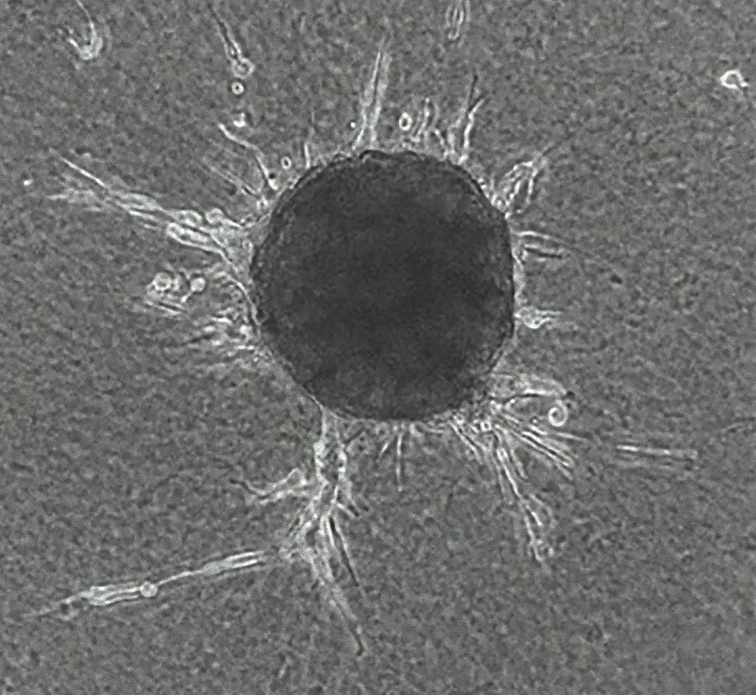 hVps37A gene ovarian cancer hVps37A gene ovarian cancer