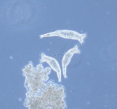 bdelloid rotifer Philodina roseola bdelloid rotifer Philodina roseola