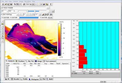 Isabel Fdez Corcobado, Institute of Legal Medicine of Granada, 2006. Software courtesy of Alava Ingenieros, S.A. Isabel Fdez Corcobado, Institute of Legal Medicine of Granada, 2006. Software courtesy of Alava Ingenieros, S.A.
