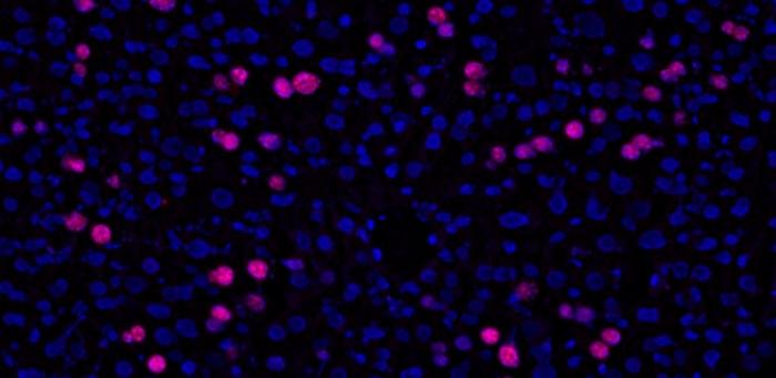 hepatocytes_dividing_during_the_liver_regeneration_process_after_hmb_supplementation