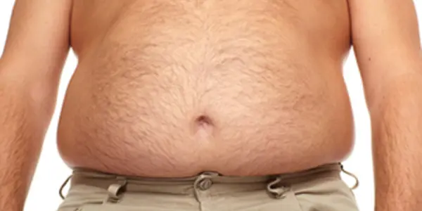 Fit Fat: Exercise Helps Even If You Aren't Thin
