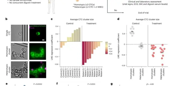 Cardiac Medication Digoxin Off Label Reduces Risk Of Breast Cancer Metastases