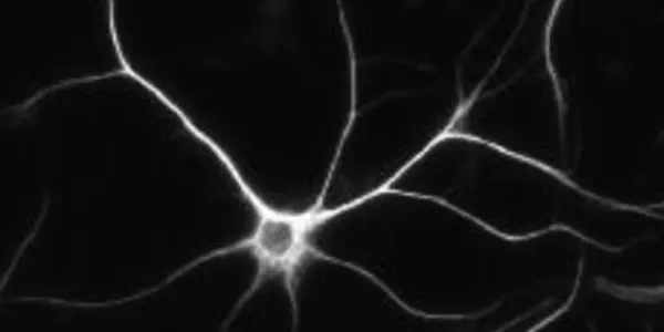 Could Niacin Be Added To Glioblastoma Treatment? - article teaser image