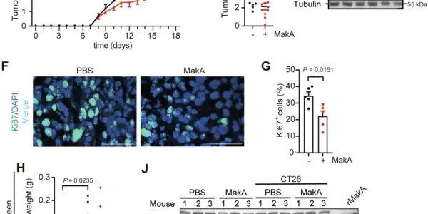 Using Cholera To Battle Colorectal Cancer