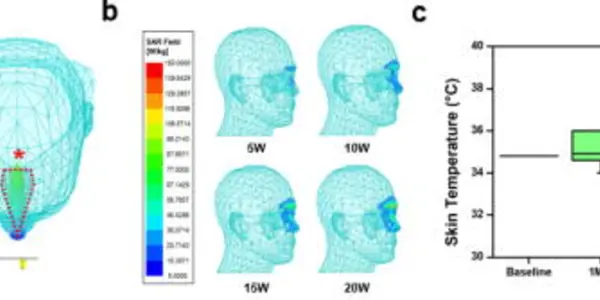 No Sense Of Smell? Try Radio Waves