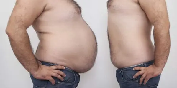 American Heart Association: Thank Ozempic For Less Type 2 DIabetes