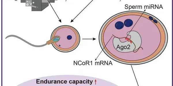 Sperm MicroRNAs May Make Your Unwillingness To Exercise Inherited