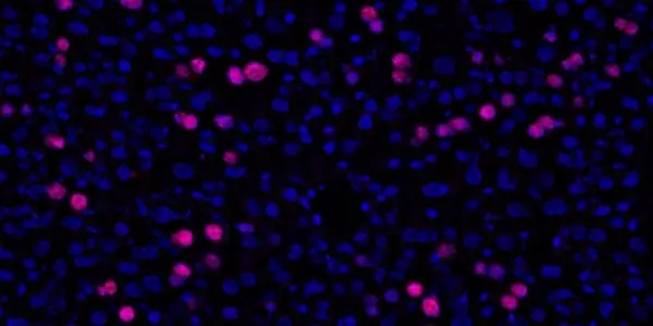 Mice Given Supplement Before Surgery Experience Greater Liver Regeneration