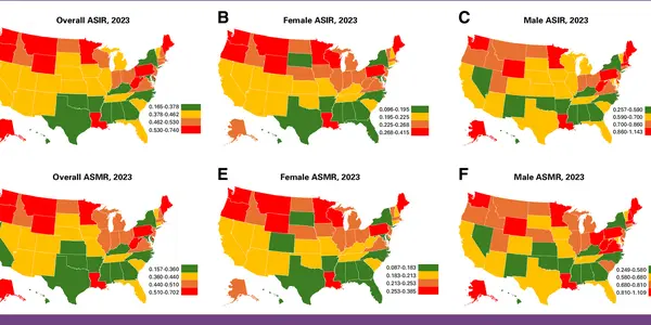Mesothelioma Cases In Women Increase 50 Years After Asbestos Bans - article teaser image